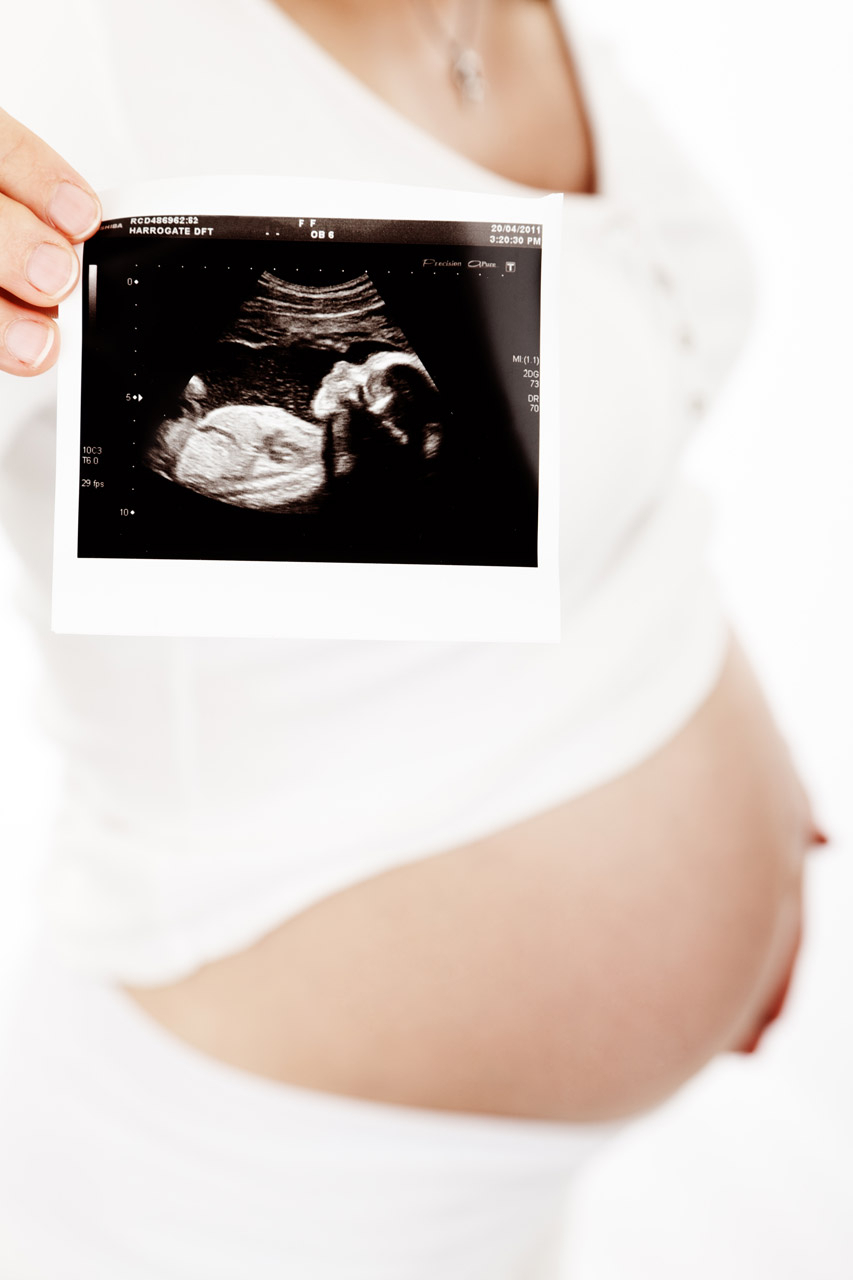В Чепецке беременную здоровым ребенком девушку отправили на аборт