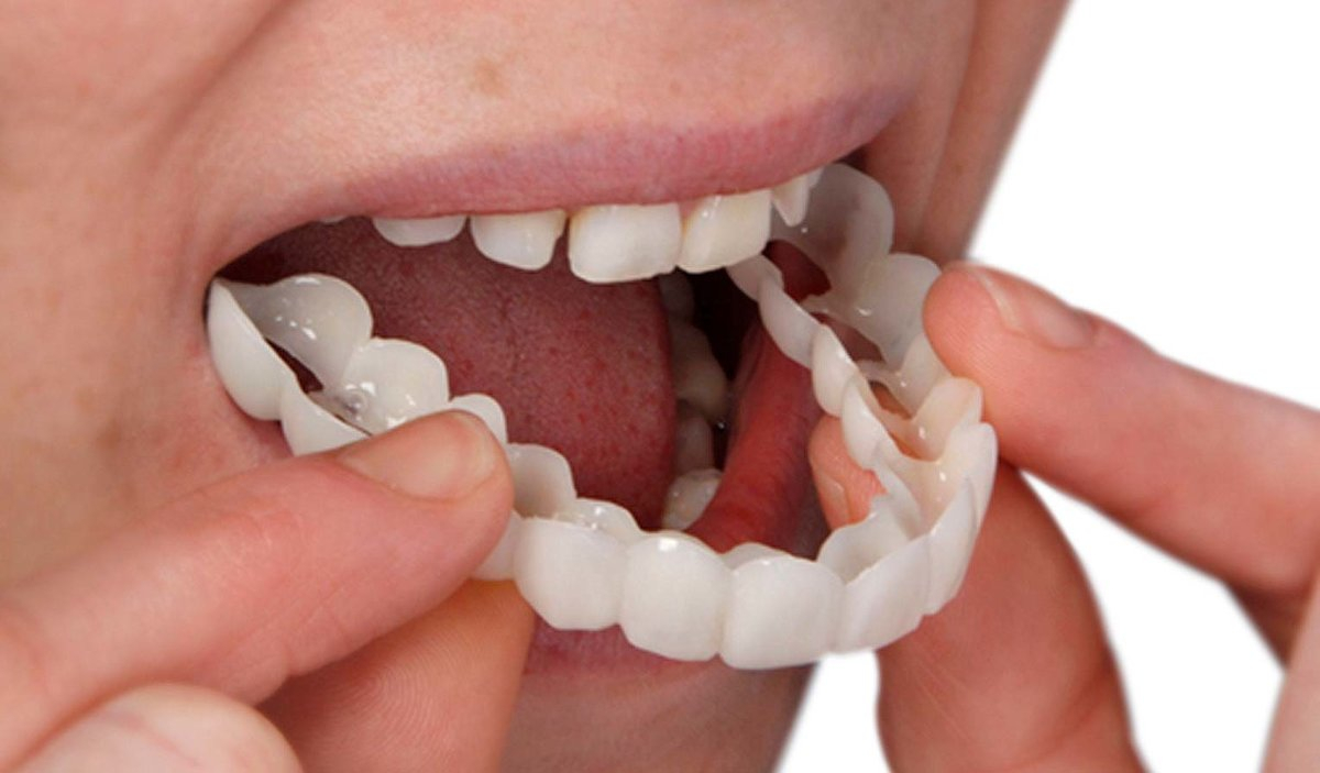 Какой зубной протез подойдет именно вам?