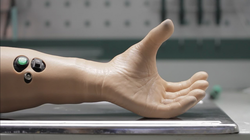 В Кирове впервые поставят протезы, напечатанные на 3D-принтере