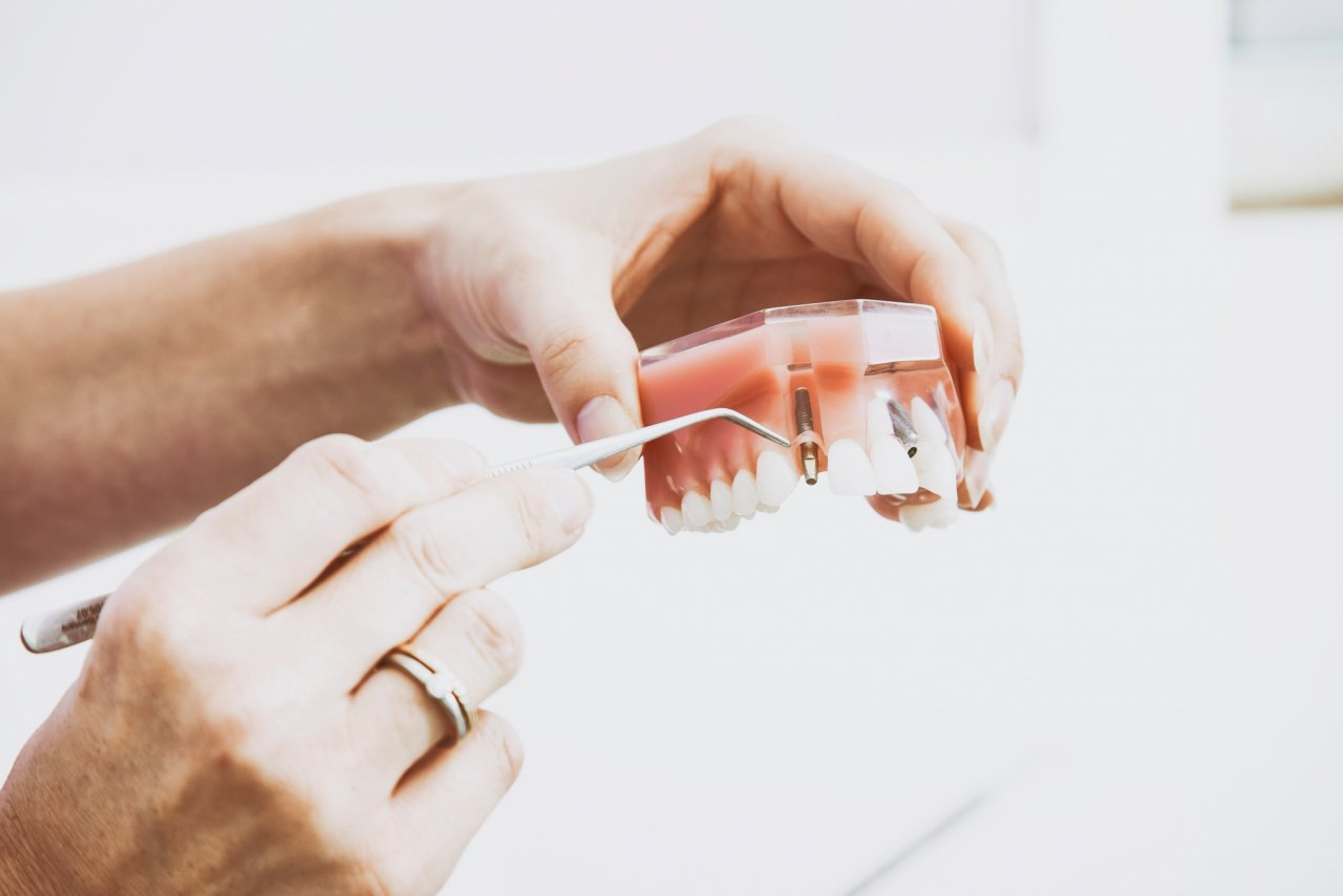 Стоматологи рассказали, чем опасно отсутствие  одного зуба