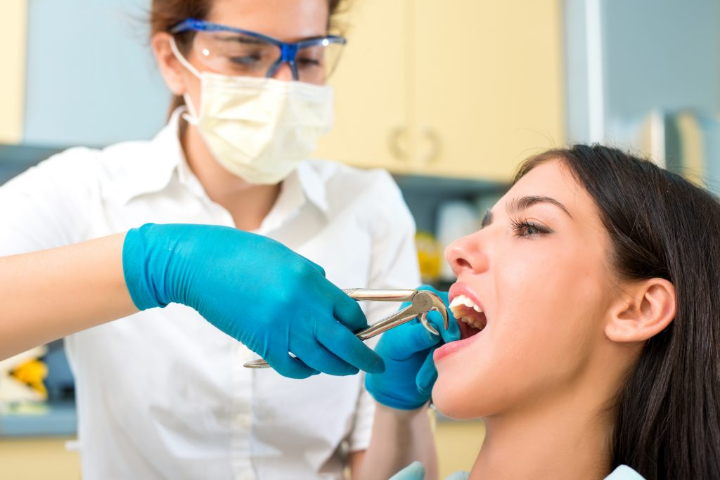 Прикус нарушится, уменьшится лицо: кировские стоматологи рассказали, что происходит после удаления зуба