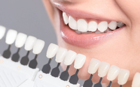 Что нужно знать про отбеливание зубов?