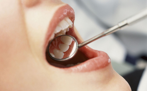 Протезирование зубов: подойдет ли вам бюгельный протез квадротти?