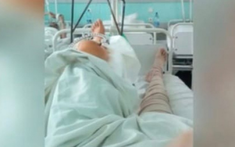 В Кирове мужчина получил двойной перелом после падения на улице